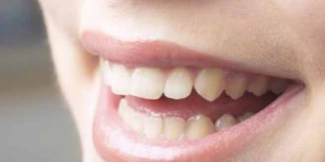 8 Ways to Remove Tea Stains from Your Teeth
