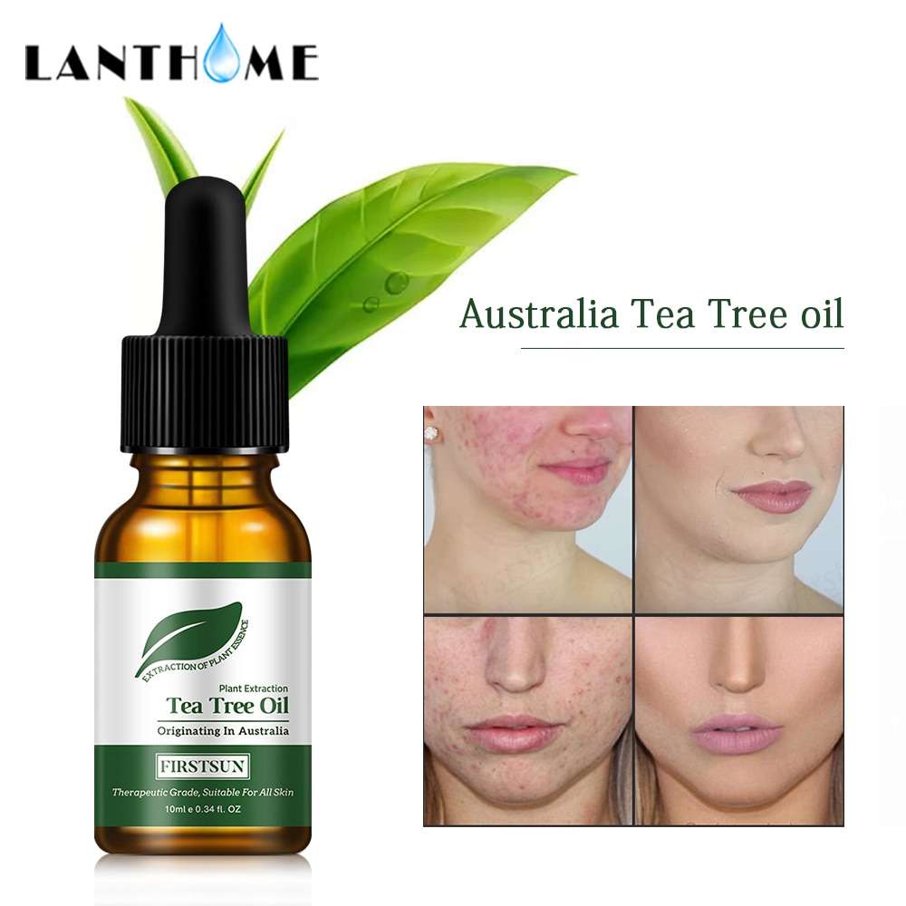 Can I Use Tea Tree Oil For Acne Scars