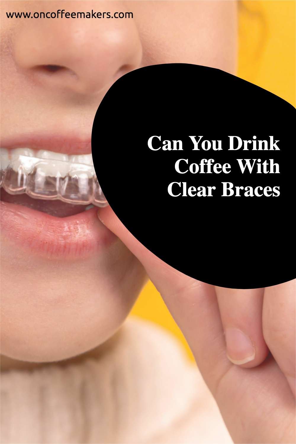Can You Drink Coffee With Clear Braces