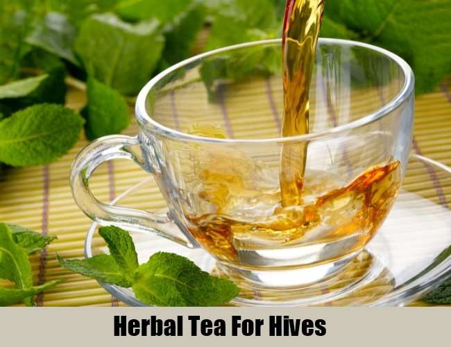Herbal Tea For Hives