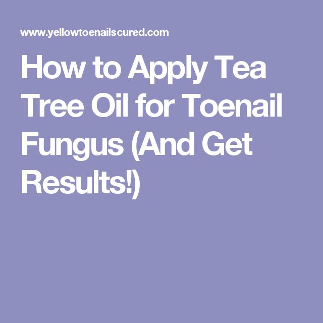How to Apply Tea Tree Oil for Toenail Fungus â Yellow Toenails Cured ...
