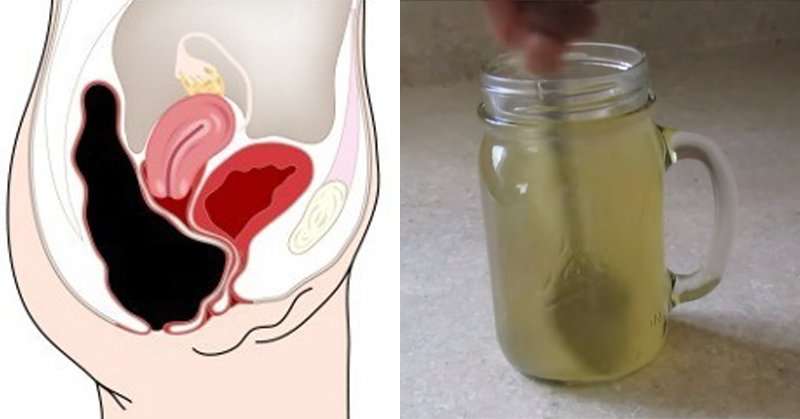 How to Detox and Relieve Constipation with this Honey Drink