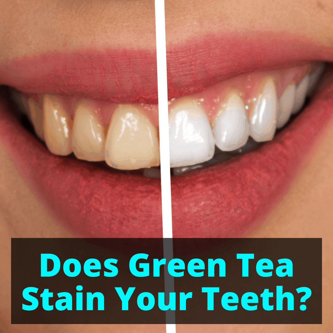How To Get Rid Of Coffee Tea Stains On Teeth / 10 Ways Help You To ...