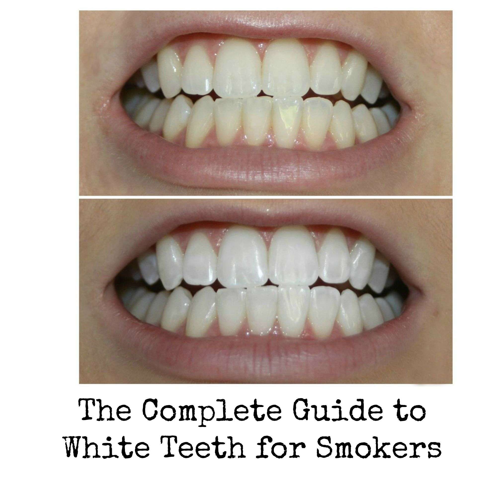 How To Get Stains Off Teeth From Smoking