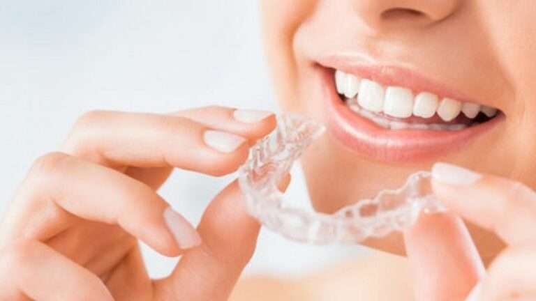 What Can I Drink With Invisalign: Details About Invisalign
